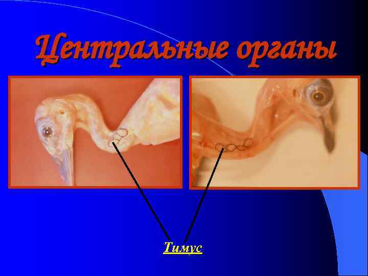 Центральные органы Тимус 