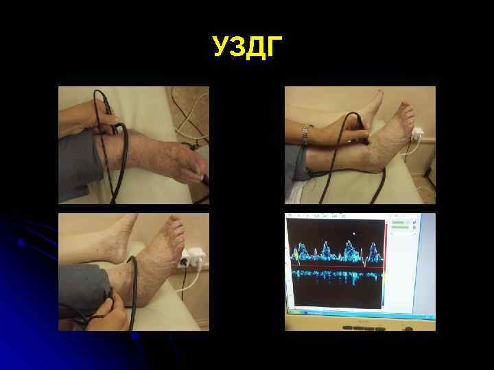УЗДГ 
