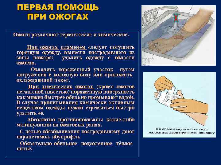 ПЕРВАЯ ПОМОЩЬ ПРИ ОЖОГАХ Ожоги различают термические и химические. При ожогах пламенем следует потушить