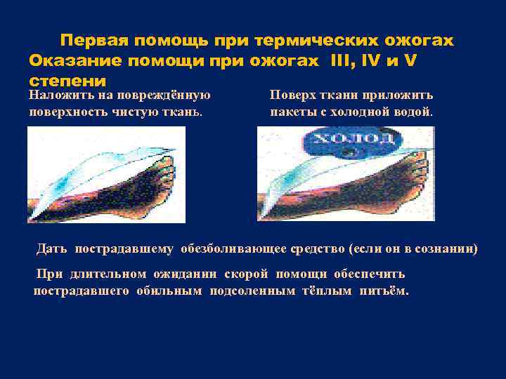 Первая помощь при термических ожогах Оказание помощи при ожогах III, IV и V степени