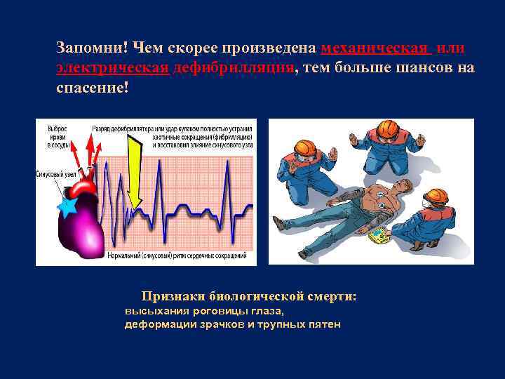  Запомни! Чем скорее произведена механическая или электрическая дефибрилляция, тем больше шансов на спасение!