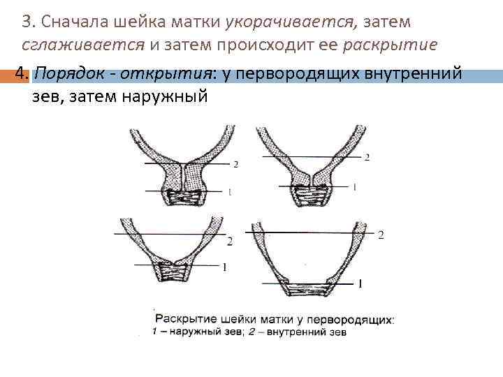 3. Сначала шейка матки укорачивается, затем сглаживается и затем происходит ее раскрытие 4. Порядок