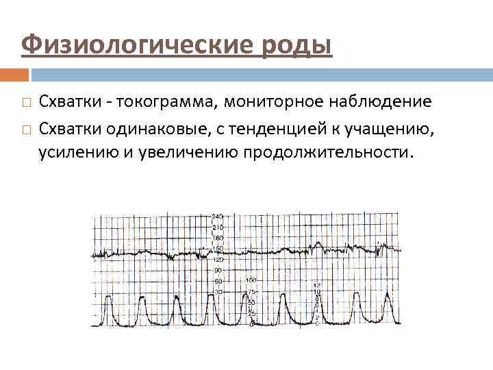 Физиологические роды Схватки - токограмма, мониторное наблюдение Схватки одинаковые, с тенденцией к учащению, усилению