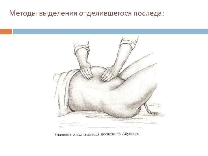 Методы выделения отделившегося последа: 