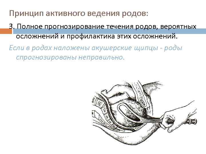 Принцип активного ведения родов: 3. Полное прогнозирование течения родов, вероятных осложнений и профилактика этих