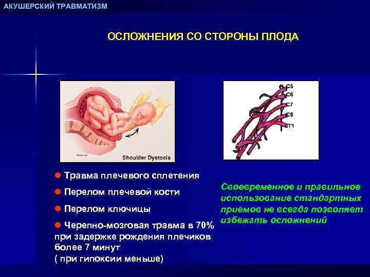 АКУШЕРСКИЙ ТРАВМАТИЗМ ОСЛОЖНЕНИЯ СО СТОРОНЫ ПЛОДА l Травма плечевого сплетения l Перелом плечевой кости