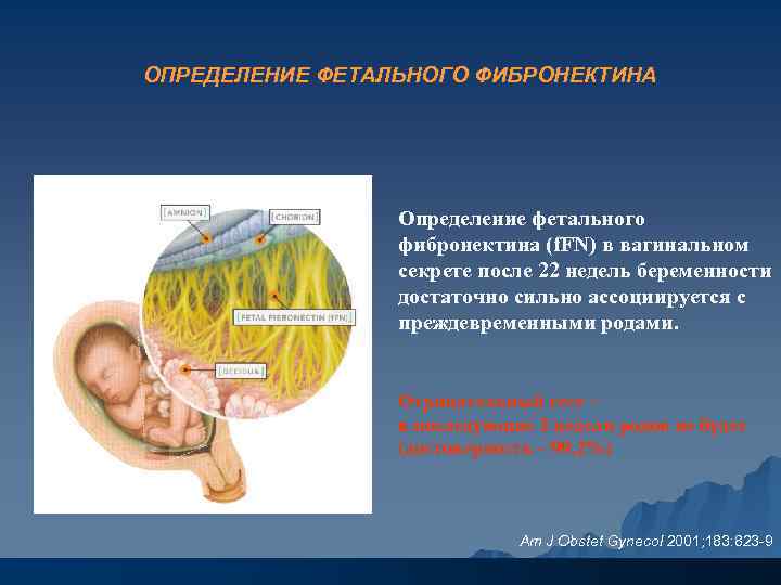 ОПРЕДЕЛЕНИЕ ФЕТАЛЬНОГО ФИБРОНЕКТИНА Определение фетального фибронектина (f. FN) в вагинальном секрете после 22 недель