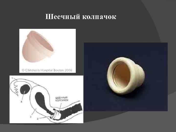 Шеечный колпачок 