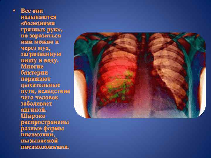  • Все они называются «болезнями грязных рук» , но заразиться ими можно и