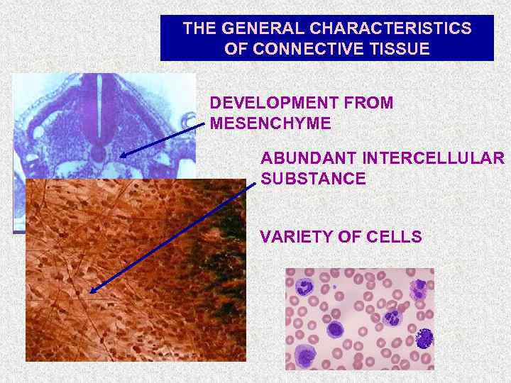 THE GENERAL CHARACTERISTICS OF CONNECTIVE TISSUE DEVELOPMENT FROM MESENCHYME ABUNDANT INTERCELLULAR SUBSTANCE VARIETY OF