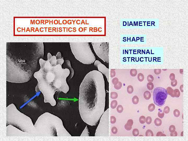 MORPHOLOGYCAL CHARACTERISTICS OF RBC DIAMETER SHAPE INTERNAL STRUCTURE 