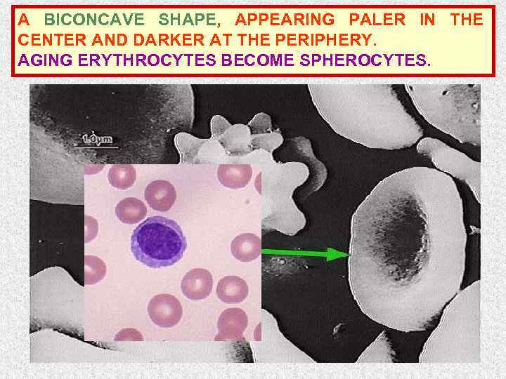 A BICONCAVE SHAPE, APPEARING PALER IN THE CENTER AND DARKER AT THE PERIPHERY. AGING