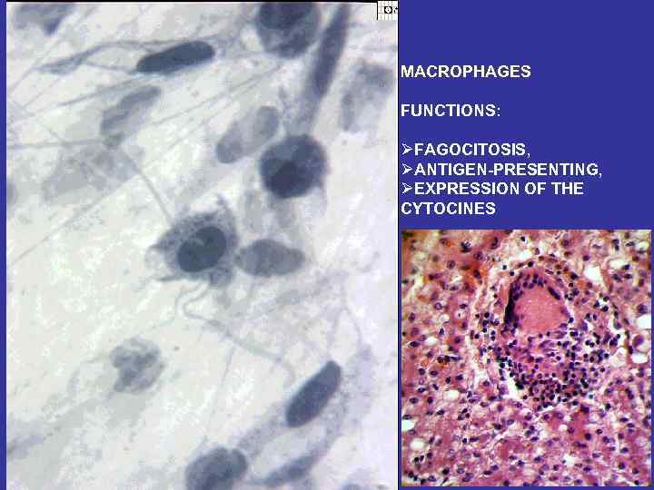MACROPHAGES FUNCTIONS: ØFAGOCITOSIS, ØANTIGEN-PRESENTING, ØEXPRESSION OF THE CYTOCINES 