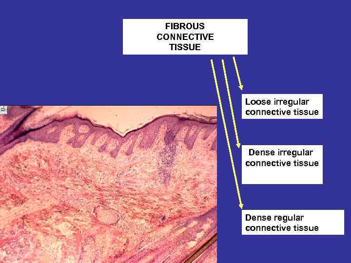 FIBROUS CONNECTIVE TISSUE Loose irregular connective tissue Dense regular connective tissue 