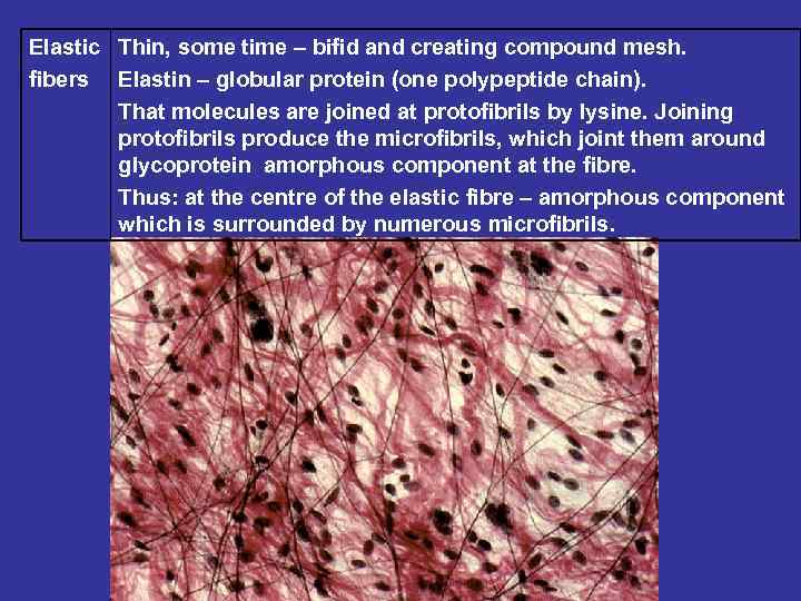 Elastic Thin, some time – bifid and creating compound mesh. fibers Elastin – globular