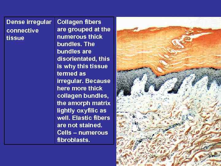 Dense irregular Collagen fibers are grouped at the connective numerous thick tissue bundles. The