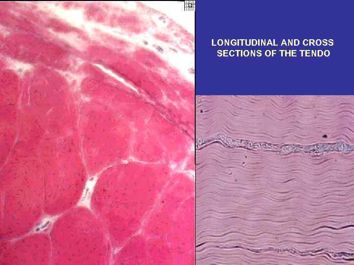 LONGITUDINAL AND CROSS SECTIONS OF THE TENDO 