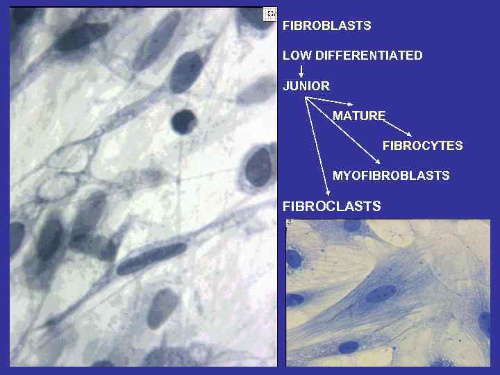 FIBROBLASTS LOW DIFFERENTIATED JUNIOR MATURE FIBROCYTES MYOFIBROBLASTS FIBROCLASTS 