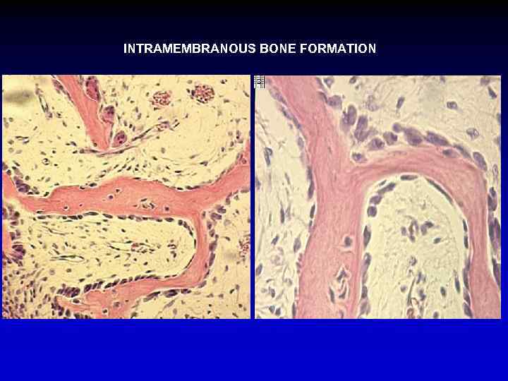 INTRAMEMBRANOUS BONE FORMATION 