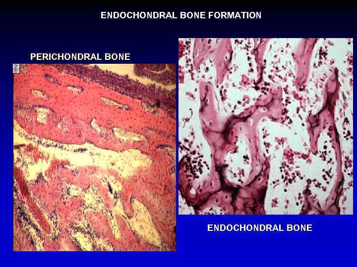 ENDOCHONDRAL BONE FORMATION PERICHONDRAL BONE ENDOCHONDRAL BONE 