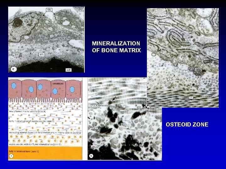 MINERALIZATION OF BONE MATRIX OSTEOID ZONE 