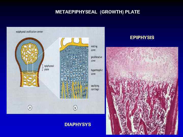 METAEPIPHYSEAL (GROWTH) PLATE EPIPHYSIS DIAPHYSYS 