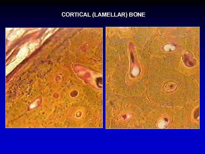 CORTICAL (LAMELLAR) BONE 