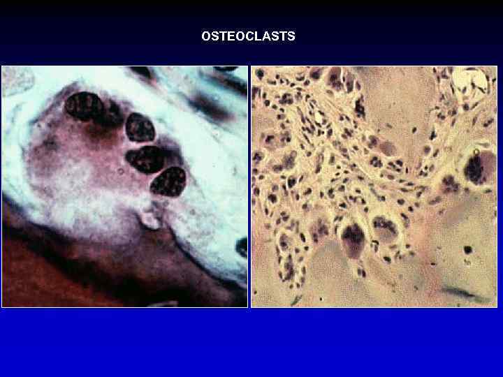 OSTEOCLASTS 