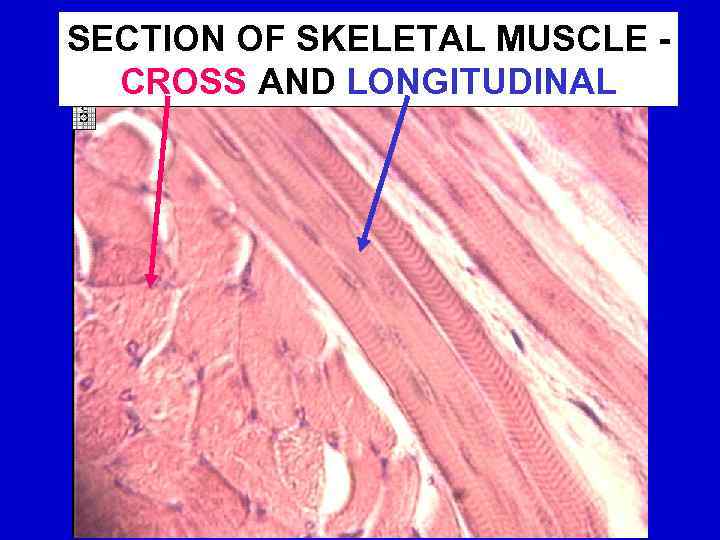 SECTION OF SKELETAL MUSCLE CROSS AND LONGITUDINAL 