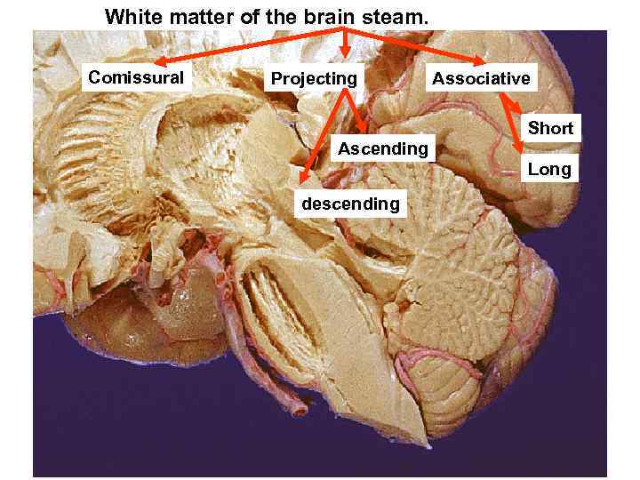 White matter of the brain steam. Comissural Projecting Associative Short Ascending Long descending 