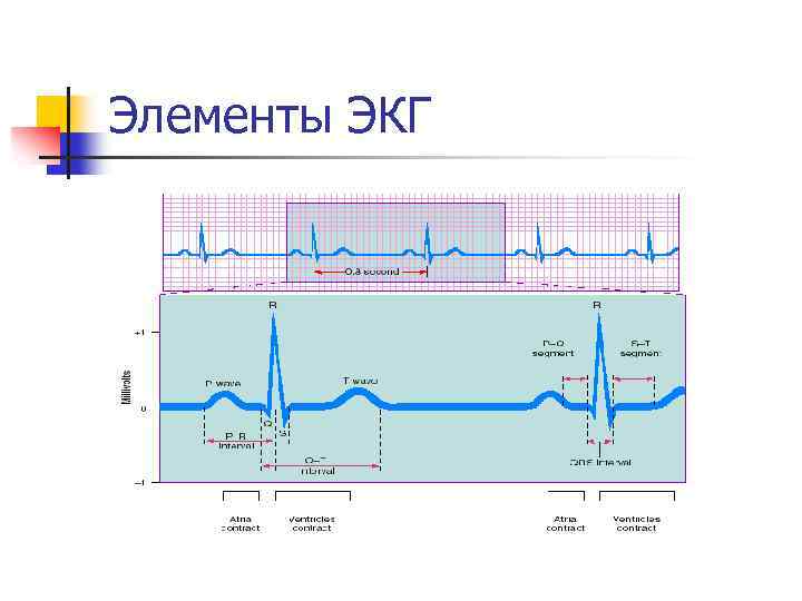 Элементы ЭКГ 