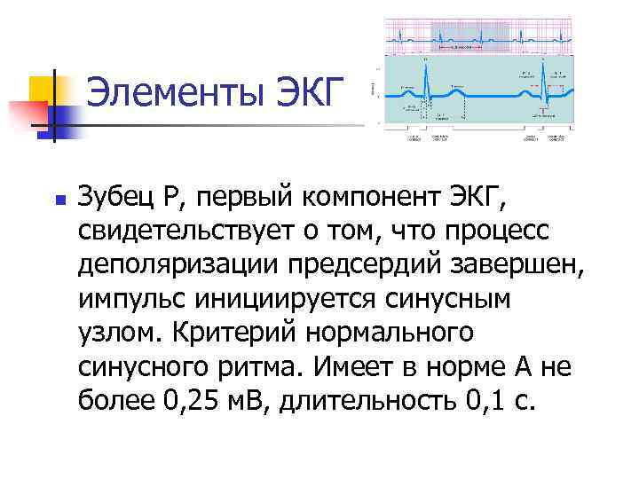 Элементы ЭКГ n Зубец Р, первый компонент ЭКГ, свидетельствует о том, что процесс деполяризации