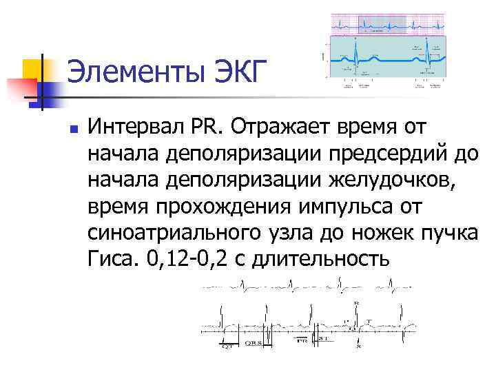 Элементы ЭКГ n Интервал РR. Отражает время от начала деполяризации предсердий до начала деполяризации
