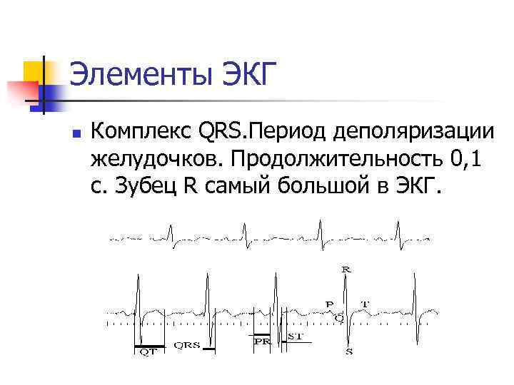 Элементы ЭКГ n Комплекс QRS. Период деполяризации желудочков. Продолжительность 0, 1 с. Зубец R