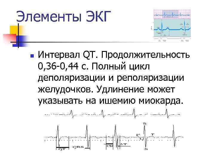 Элементы ЭКГ n Интервал QT. Продолжительность 0, 36 -0, 44 с. Полный цикл деполяризации