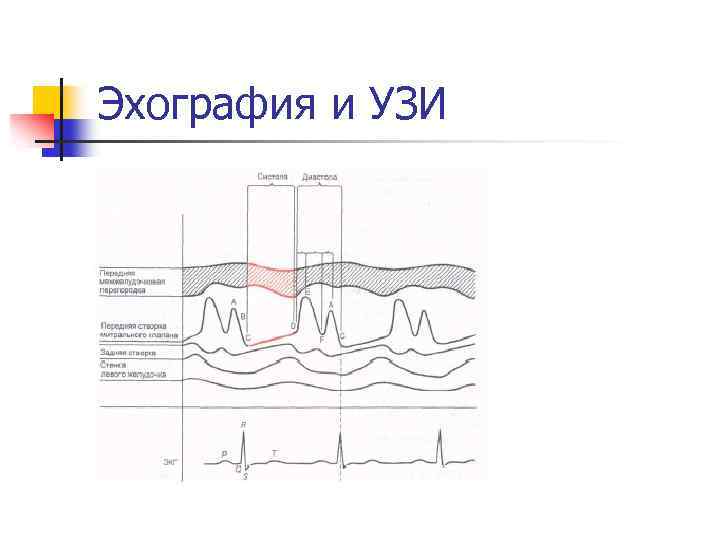 Эхография и УЗИ 