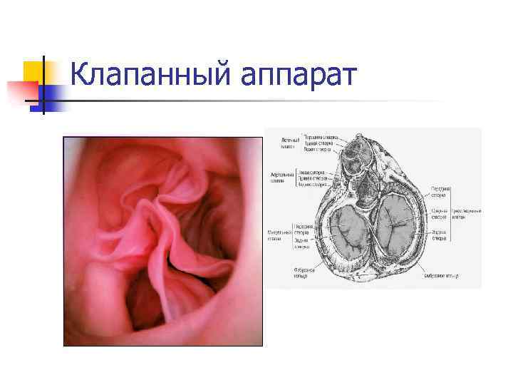 Клапанный аппарат 