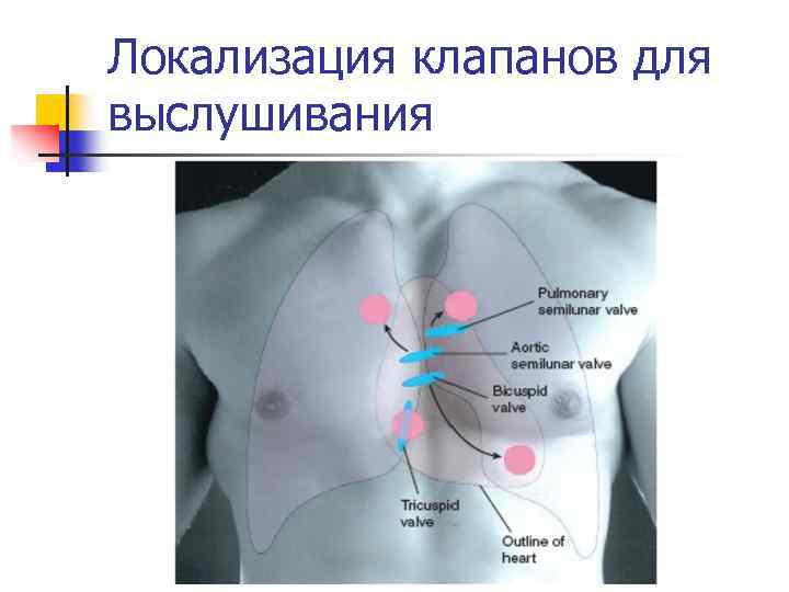 Локализация клапанов для выслушивания 