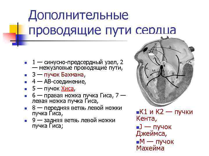 Сердце с тремя парами щелевидных отверстий. Проводящая система сердца патологические пучки. Патологические проводящие пути сердца. Дополнительные проводящие пути сердца. Схема проводящих путей сердца.