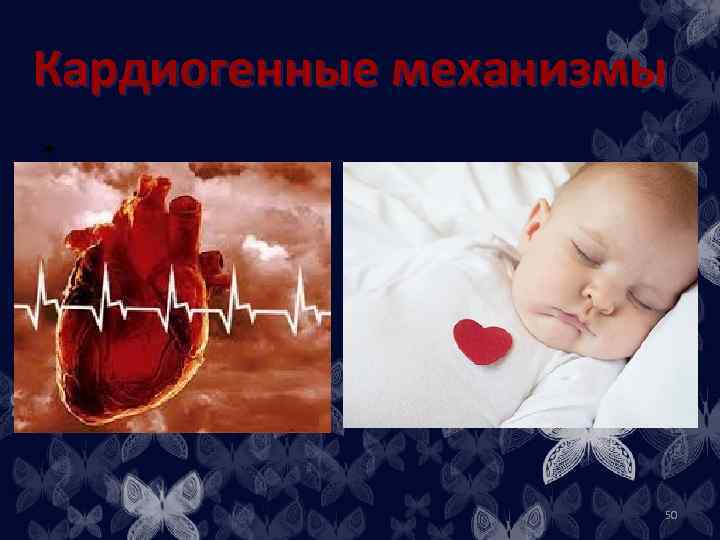 Кардиогенные механизмы • 50 