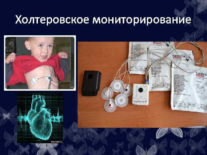 Холтеровское мониторирование • 62 