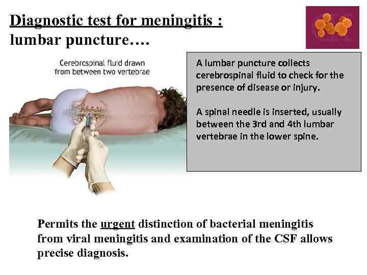 Diagnostic test for meningitis : lumbar puncture…. A lumbar puncture collects cerebrospinal fluid to