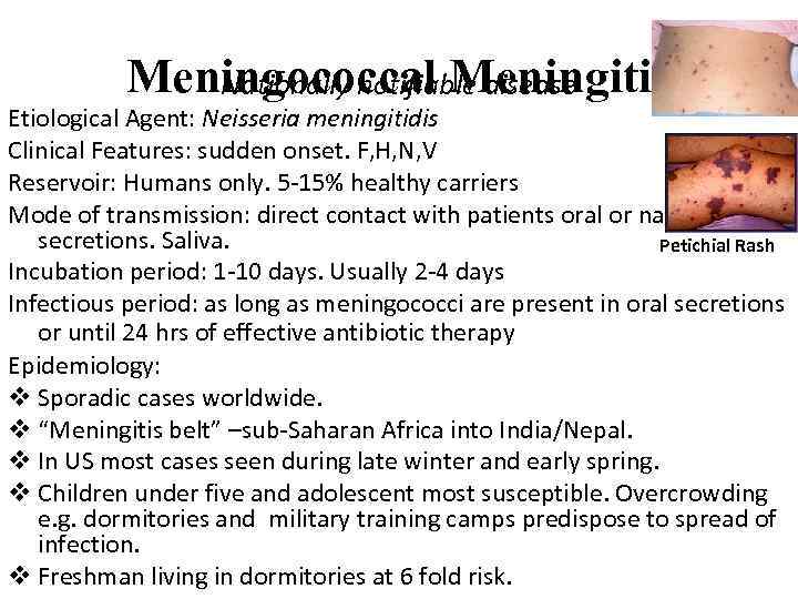 Meningococcal Meningitis Nationally notifiable disease Etiological Agent: Neisseria meningitidis Clinical Features: sudden onset. F,