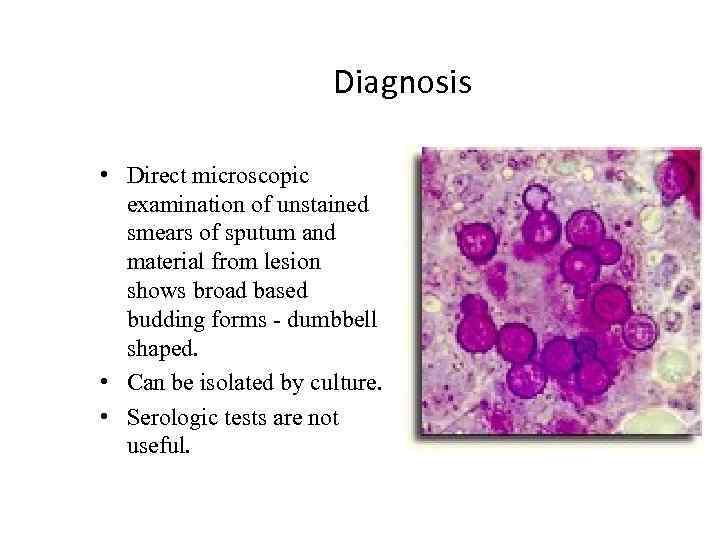 Diagnosis • Direct microscopic examination of unstained smears of sputum and material from lesion