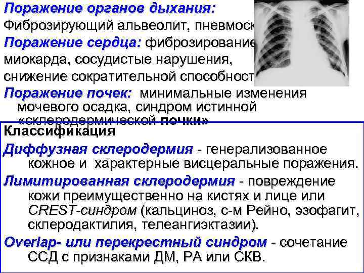 Поражение органов дыхания: Фиброзирующий альвеолит, пневмосклероз Поражение сердца: фиброзирование миокарда, сосудистые нарушения, снижение сократительной