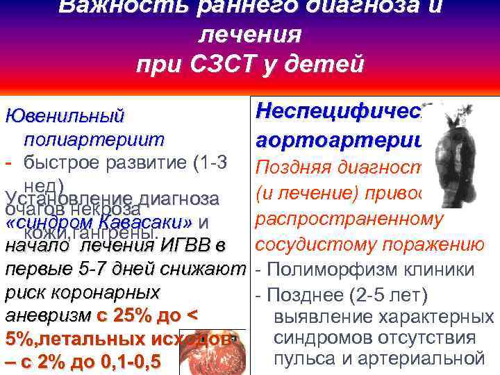 Важность раннего диагноза и лечения при СЗСТ у детей Ювенильный полиартериит - быстрое развитие