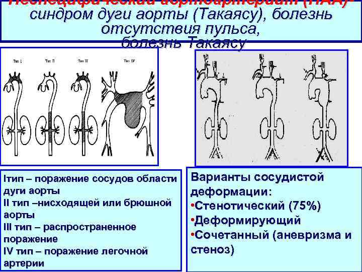 Для клинической картины болезни такаясу характерно