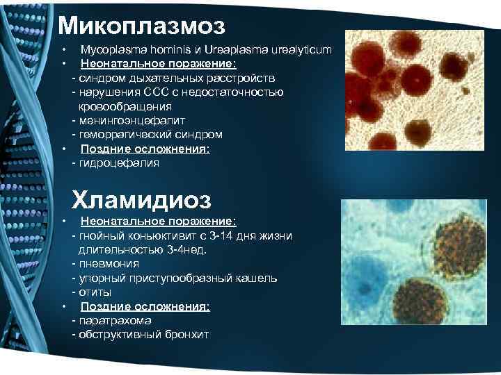 Микоплазмоз • • Mycoplasma hominis и Ureaplasma urealyticum Неонатальное поражение: - синдром дыхательных расстройств