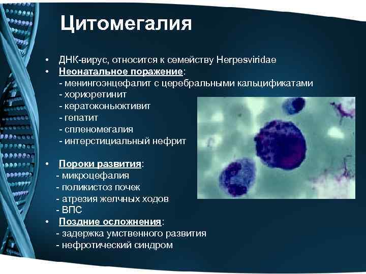 Циталомегавирус. Вирусы цитомегалии относится к семейству:. Врожденная цитомегалия признаки.