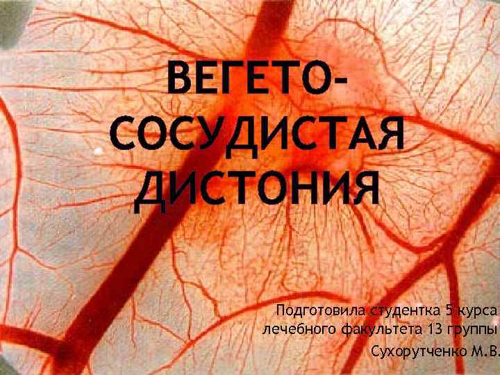 ВЕГЕТОСОСУДИСТАЯ ДИСТОНИЯ Подготовила студентка 5 курса лечебного факультета 13 группы Сухорутченко М. В. 